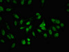 Immunofluorescent analysis of Hela cells using CSB-PA774811LA01HU at dilution of 1:100 and Alexa Fluor 488-congugated AffiniPure Goat Anti-Rabbit IgG (H+L)