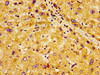 Immunohistochemistry of paraffin-embedded human liver tissue using CSB-PA845148LA01HU at dilution of 1: 100 Immunohistochemistry of paraffin-embedded human liver tissue using CSB-PA845148LA01HU at dilution of 1: 100