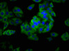 Immunofluorescence staining of HepG2 cells with CSB-PA845148LA01HU at 1: 133, counter-stained with DAPI. The cells were fixed in 4% formaldehyde, permeabilized tissue using 0.2% Triton X-100 and blocked in 10% normal Goat Serum. The cells were then incubated with the antibody overnight at 4°C.The secondary antibody was Alexa Fluor 488-congugated AffiniPure Goat Anti-Rabbit IgG (H+L) . Immunofluorescence staining of HepG2 cells with CSB-PA845148LA01HU at 1: 133, counter-stained with DAPI. The cells were fixed in 4% formaldehyde, permeabilized tissue using 0.2% Triton X-100 and blocked in 10% normal Goat Serum. The cells were then incubated with the antibody overnight at 4°C.The secondary antibody was Alexa Fluor 488-congugated AffiniPure Goat Anti-Rabbit IgG (H+L) .