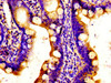 Immunohistochemistry of paraffin-embedded human small intestine tissue using CSB-PA846585LA01HU at dilution of 1:100