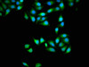 Immunofluorescence staining of Hela cells with CSB-PA846585LA01HU at 1:133, counter-stained with DAPI. The cells were fixed in 4% formaldehyde, permeabilized using 0.2% Triton X-100 and blocked in 10% normal Goat Serum. The cells were then incubated with the antibody overnight at 4°C. The secondary antibody was Alexa Fluor 488-congugated AffiniPure Goat Anti-Rabbit IgG (H+L) .