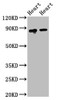 Western Blot<br />
 Positive WB detected in: Rat heart tissue, Mouse heart tissue<br />
 All lanes: ACO2 antibody at 2.5µg/ml<br />
 Secondary<br />
 Goat polyclonal to rabbit IgG at 1/50000 dilution<br />
 Predicted band size: 86 kDa<br />
 Observed band size: 86 kDa<br />