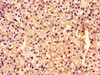 Immunohistochemistry of paraffin-embedded human adrenal gland tissue using CSB-PA868370LA01HU at dilution of 1:100