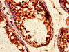 Immunohistochemistry of paraffin-embedded human testis tissue using CSB-PA868370LA01HU at dilution of 1:100