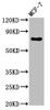 Western Blot<br />
 Positive WB detected in: MCF-7 whole cell lysate<br />
 All lanes: TUBGCP4 antibody at 3µg/ml<br />
 Secondary<br />
 Goat polyclonal to rabbit IgG at 1/50000 dilution<br />
 Predicted band size: 77 kDa<br />
 Observed band size: 77 kDa<br />