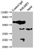 Immunoprecipitating POLDIP3 in Jurkat whole cell lysate<br />
 Lane 1: Rabbit control IgG instead of CSB-PA871610LA01HU in Jurkat whole cell lysate.
 For western blotting, a HRP-conjugated Protein G antibody was used as the secondary antibody (1/2000) <br />
 Lane 2: CSB-PA871610LA01HU (8µg) + Jurkat whole cell lysate (500µg) <br />
 Lane 3: Jurkat whole cell lysate (10µg) <br />