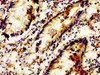 Immunohistochemistry of paraffin-embedded human appendix tissue using CSB-PA884515LA01HU at dilution of 1:100