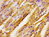 Immunohistochemistry of paraffin-embedded human heart tissue using CSB-PA888303LA01HU at dilution of 1:100