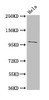 Western Blot<br />
 Positive WB detected in: Hela whole cell lysate<br />
 All lanes: NPC1 antibody at 3µg/ml<br />
 Secondary<br />
 Goat polyclonal to rabbit IgG at 1/50000 dilution<br />
 Predicted band size: 143, 108 kDa<br />
 Observed band size: 108 kDa<br />