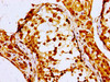 Immunohistochemistry of paraffin-embedded human testis tissue using CSB-PA890689LA01HU at dilution of 1:100