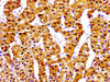 Immunohistochemistry of paraffin-embedded human adrenal gland tissue using CSB-PA890689LA01HU at dilution of 1:100