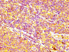 IHC image of CSB-PA001064LA01HU diluted at 1:400 and staining in paraffin-embedded human lymph node tissue performed on a Leica BondTM system. After dewaxing and hydration, antigen retrieval was mediated by high pressure in a citrate buffer (pH 6.0) . Section was blocked with 10% normal goat serum 30min at RT. Then primary antibody (1% BSA) was incubated at 4°C overnight. The primary is detected by a biotinylated secondary antibody and visualized using an HRP conjugated SP system.