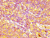 IHC image of CSB-PA001064LA01HU diluted at 1:400 and staining in paraffin-embedded human lymph node tissue performed on a Leica BondTM system. After dewaxing and hydration, antigen retrieval was mediated by high pressure in a citrate buffer (pH 6.0) . Section was blocked with 10% normal goat serum 30min at RT. Then primary antibody (1% BSA) was incubated at 4°C overnight. The primary is detected by a biotinylated secondary antibody and visualized using an HRP conjugated SP system. IHC image of CSB-PA001064LA01HU diluted at 1:400 and staining in paraffin-embedded human lymph node tissue performed on a Leica BondTM system. After dewaxing and hydration, antigen retrieval was mediated by high pressure in a citrate buffer (pH 6.0) . Section was blocked with 10% normal goat serum 30min at RT. Then primary antibody (1% BSA) was incubated at 4°C overnight. The primary is detected by a biotinylated secondary antibody and visualized using an HRP conjugated SP system.