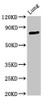 Western Blot<br />
 Positive WB detected in: Rat lung tissue<br />
 All lanes: ATXN7 antibody at 3.3µg/ml<br />
 Secondary<br />
 Goat polyclonal to rabbit IgG at 1/50000 dilution<br />
 Predicted band size: 96, 102, 80 kDa<br />
 Observed band size: 80 kDa<br />