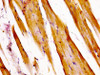 IHC image of CSB-PA002445LA01HU diluted at 1:400 and staining in paraffin-embedded human skeletal muscle tissue performed on a Leica BondTM system. After dewaxing and hydration, antigen retrieval was mediated by high pressure in a citrate buffer (pH 6.0) . Section was blocked with 10% normal goat serum 30min at RT. Then primary antibody (1% BSA) was incubated at 4°C overnight. The primary is detected by a biotinylated secondary antibody and visualized using an HRP conjugated SP system.