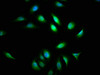 Immunofluorescence staining of A549 cells with CSB-PA002445LA01HU at 1:133, counter-stained with DAPI. The cells were fixed in 4% formaldehyde, permeabilized using 0.2% Triton X-100 and blocked in 10% normal Goat Serum. The cells were then incubated with the antibody overnight at 4°C. The secondary antibody was Alexa Fluor 488-congugated AffiniPure Goat Anti-Rabbit IgG (H+L) .