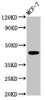 Western Blot<br />
 Positive WB detected in: MCF-7 whole cell lysate<br />
 All lanes: BDKRB2 antibody at 4.2µg/ml<br />
 Secondary<br />
 Goat polyclonal to rabbit IgG at 1/50000 dilution<br />
 Predicted band size: 45, 42 kDa<br />
 Observed band size: 45 kDa<br />