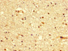 IHC image of CSB-PA002652LA01HU diluted at 1:300 and staining in paraffin-embedded human brain tissue performed on a Leica BondTM system. After dewaxing and hydration, antigen retrieval was mediated by high pressure in a citrate buffer (pH 6.0) . Section was blocked with 10% normal goat serum 30min at RT. Then primary antibody (1% BSA) was incubated at 4°C overnight. The primary is detected by a biotinylated secondary antibody and visualized using an HRP conjugated SP system.