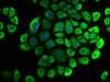 Immunofluorescence staining of Hela cells with CSB-PA005666LA01HU at 1:33, counter-stained with DAPI. The cells were fixed in 4% formaldehyde, permeabilized using 0.2% Triton X-100 and blocked in 10% normal Goat Serum. The cells were then incubated with the antibody overnight at 4°C. The secondary antibody was Alexa Fluor 488-congugated AffiniPure Goat Anti-Rabbit IgG (H+L) .