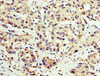 IHC image of CSB-PA005925LA01HU diluted at 1:200 and staining in paraffin-embedded human liver cancer performed on a Leica BondTM system. After dewaxing and hydration, antigen retrieval was mediated by high pressure in a citrate buffer (pH 6.0) . Section was blocked with 10% normal goat serum 30min at RT. Then primary antibody (1% BSA) was incubated at 4°C overnight. The primary is detected by a biotinylated secondary antibody and visualized using an HRP conjugated SP system.