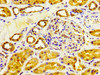 IHC image of CSB-PA006451LA01HU diluted at 1:200 and staining in paraffin-embedded human kidney tissue performed on a Leica BondTM system. After dewaxing and hydration, antigen retrieval was mediated by high pressure in a citrate buffer (pH 6.0) . Section was blocked with 10% normal goat serum 30min at RT. Then primary antibody (1% BSA) was incubated at 4°C overnight. The primary is detected by a biotinylated secondary antibody and visualized using an HRP conjugated SP system.