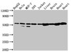 Western Blot<br />
 Positive WB detected in: HepG2 whole cell lysate, Hela whole cell lysate, MCF-7 whole cell lysate, 293 whole cell lysate, Jurkat whole cell lysate, Rat liver tissue, Rat brain tissue, Rat heart tissue, Mouse heart tissue<br />
 All lanes: DLD antibody at 2µg/ml<br />
 Secondary<br />
 Goat polyclonal to rabbit IgG at 1/50000 dilution<br />
 Predicted band size: 55, 44, 50 kDa<br />
 Observed band size: 55 kDa<br />