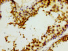 IHC image of CSB-PA011904LA01HU diluted at 1:400 and staining in paraffin-embedded human testis tissue performed on a Leica BondTM system. After dewaxing and hydration, antigen retrieval was mediated by high pressure in a citrate buffer (pH 6.0) . Section was blocked with 10% normal goat serum 30min at RT. Then primary antibody (1% BSA) was incubated at 4°C overnight. The primary is detected by a biotinylated secondary antibody and visualized using an HRP conjugated SP system.