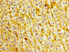 IHC image of CSB-PA011904LA01HU diluted at 1:400 and staining in paraffin-embedded human adrenal gland tissue performed on a Leica BondTM system. After dewaxing and hydration, antigen retrieval was mediated by high pressure in a citrate buffer (pH 6.0) . Section was blocked with 10% normal goat serum 30min at RT. Then primary antibody (1% BSA) was incubated at 4°C overnight. The primary is detected by a biotinylated secondary antibody and visualized using an HRP conjugated SP system.