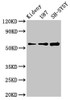 Western Blot<br />
 Positive WB detected in: Mouse kidney tissue, U87 whole cell lysate, SH-SY5Y whole cell lysate<br />
 All lanes: KCNAB1 antibody at 3.9µg/ml<br />
 Secondary<br />
 Goat polyclonal to rabbit IgG at 1/50000 dilution<br />
 Predicted band size: 47, 45, 46 kDa<br />
 Observed band size: 60 kDa<br />
