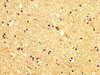 IHC image of CSB-PA012013LA01HU diluted at 1:200 and staining in paraffin-embedded human brain tissue performed on a Leica BondTM system. After dewaxing and hydration, antigen retrieval was mediated by high pressure in a citrate buffer (pH 6.0) . Section was blocked with 10% normal goat serum 30min at RT. Then primary antibody (1% BSA) was incubated at 4°C overnight. The primary is detected by a biotinylated secondary antibody and visualized using an HRP conjugated SP system.