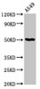 Western Blot<br />
 Positive WB detected in: A549 whole cell lysate<br />
 All lanes: GDI1 antibody at 6µg/ml<br />
 Secondary<br />
 Goat polyclonal to rabbit IgG at 1/50000 dilution<br />
 Predicted band size: 51 kDa<br />
 Observed band size: 51 kDa<br />