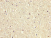 IHC image of CSB-PA01229A0Rb diluted at 1:200 and staining in paraffin-embedded human brain tissue performed on a Leica BondTM system. After dewaxing and hydration, antigen retrieval was mediated by high pressure in a citrate buffer (pH 6.0) . Section was blocked with 10% normal goat serum 30min at RT. Then primary antibody (1% BSA) was incubated at 4°C overnight. The primary is detected by a biotinylated secondary antibody and visualized using an HRP conjugated SP system.