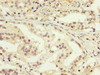 IHC image of CSB-PA01229A0Rb diluted at 1:200 and staining in paraffin-embedded human prostate cancer performed on a Leica BondTM system. After dewaxing and hydration, antigen retrieval was mediated by high pressure in a citrate buffer (pH 6.0) . Section was blocked with 10% normal goat serum 30min at RT. Then primary antibody (1% BSA) was incubated at 4°C overnight. The primary is detected by a biotinylated secondary antibody and visualized using an HRP conjugated SP system.