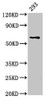 Western Blot<br />
 Positive WB detected in: 293 whole cell lysate<br />
 All lanes: LPCAT2 antibody at 5µg/ml<br />
 Secondary<br />
 Goat polyclonal to rabbit IgG at 1/50000 dilution<br />
 Predicted band size: 61, 31 kDa<br />
 Observed band size: 61 kDa<br />