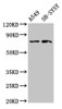 Western Blot<br />
 Positive WB detected in: A549 whole cell lysate, SH-SY5Y whole cell lysate<br />
 All lanes: MASP2 antibody at 2.7µg/ml<br />
 Secondary<br />
 Goat polyclonal to rabbit IgG at 1/50000 dilution<br />
 Predicted band size: 76, 21 kDa<br />
 Observed band size: 76 kDa<br />