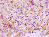 IHC image of CSB-PA013791LA01HU diluted at 1:100 and staining in paraffin-embedded human liver tissue performed on a Leica BondTM system. After dewaxing and hydration, antigen retrieval was mediated by high pressure in a citrate buffer (pH 6.0) . Section was blocked with 10% normal goat serum 30min at RT. Then primary antibody (1% BSA) was incubated at 4°C overnight. The primary is detected by a biotinylated secondary antibody and visualized using an HRP conjugated SP system.