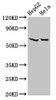 Western Blot<br />
 Positive WB detected in: HepG2 whole cell lysate, Hela whole cell lysate<br />
 All lanes: MT-ND5 antibody at 4.6µg/ml<br />
 Secondary<br />
 Goat polyclonal to rabbit IgG at 1/50000 dilution<br />
 Predicted band size: 68 kDa<br />
 Observed band size: 68 kDa<br />