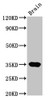 Western Blot<br />
 Positive WB detected in: Rat brain tissue<br />
 All lanes: NKX3-2 antibody at 4.5µg/ml<br />
 Secondary<br />
 Goat polyclonal to rabbit IgG at 1/50000 dilution<br />
 Predicted band size: 35 kDa<br />
 Observed band size: 35 kDa<br />