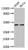 Western Blot<br />
 Positive WB detected in: A549 whole cell lysate, Hela whole cell lysate<br />
 All lanes: NMBR antibody at 4.4µg/ml<br />
 Secondary<br />
 Goat polyclonal to rabbit IgG at 1/50000 dilution<br />
 Predicted band size: 44 kDa<br />
 Observed band size: 44 kDa<br />