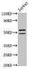 Western Blot<br />
 Positive WB detected in: Jurkat whole cell lysate<br />
 All lanes: NOVA1 antibody at 2µg/ml<br />
 Secondary<br />
 Goat polyclonal to rabbit IgG at 1/50000 dilution<br />
 Predicted band size: 53, 20, 50, 52 kDa<br />
 Observed band size: 53, 50 kDa<br />