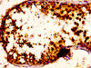 IHC image of CSB-PA015957LA01HU diluted at 1:100 and staining in paraffin-embedded human testis tissue performed on a Leica BondTM system. After dewaxing and hydration, antigen retrieval was mediated by high pressure in a citrate buffer (pH 6.0) . Section was blocked with 10% normal goat serum 30min at RT. Then primary antibody (1% BSA) was incubated at 4°C overnight. The primary is detected by a biotinylated secondary antibody and visualized using an HRP conjugated SP system.