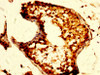 IHC image of CSB-PA016361LA01HU diluted at 1:500 and staining in paraffin-embedded human testis tissue performed on a Leica BondTM system. After dewaxing and hydration, antigen retrieval was mediated by high pressure in a citrate buffer (pH 6.0) . Section was blocked with 10% normal goat serum 30min at RT. Then primary antibody (1% BSA) was incubated at 4°C overnight. The primary is detected by a biotinylated secondary antibody and visualized using an HRP conjugated SP system.