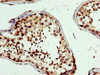 IHC image of CSB-PA017505LA01HU diluted at 1:300 and staining in paraffin-embedded human testis tissue performed on a Leica BondTM system. After dewaxing and hydration, antigen retrieval was mediated by high pressure in a citrate buffer (pH 6.0) . Section was blocked with 10% normal goat serum 30min at RT. Then primary antibody (1% BSA) was incubated at 4°C overnight. The primary is detected by a biotinylated secondary antibody and visualized using an HRP conjugated SP system. IHC image of CSB-PA017505LA01HU diluted at 1:300 and staining in paraffin-embedded human testis tissue performed on a Leica BondTM system. After dewaxing and hydration, antigen retrieval was mediated by high pressure in a citrate buffer (pH 6.0) . Section was blocked with 10% normal goat serum 30min at RT. Then primary antibody (1% BSA) was incubated at 4°C overnight. The primary is detected by a biotinylated secondary antibody and visualized using an HRP conjugated SP system.