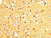 IHC image of CSB-PA017618LA01HU diluted at 1:200 and staining in paraffin-embedded human brain tissue performed on a Leica BondTM system. After dewaxing and hydration, antigen retrieval was mediated by high pressure in a citrate buffer (pH 6.0) . Section was blocked with 10% normal goat serum 30min at RT. Then primary antibody (1% BSA) was incubated at 4°C overnight. The primary is detected by a biotinylated secondary antibody and visualized using an HRP conjugated SP system.