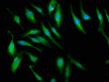 Immunofluorescence staining of Hela cells with CSB-PA017618LA01HU at 1:66, counter-stained with DAPI. The cells were fixed in 4% formaldehyde, permeabilized using 0.2% Triton X-100 and blocked in 10% normal Goat Serum. The cells were then incubated with the antibody overnight at 4°C. The secondary antibody was Alexa Fluor 488-congugated AffiniPure Goat Anti-Rabbit IgG (H+L) .