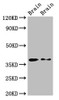 Western Blot<br />
 Positive WB detected in: Rat brain tissue, Mouse brain tissue<br />
 All lanes: PEX10 antibody at 2.7µg/ml<br />
 Secondary<br />
 Goat polyclonal to rabbit IgG at 1/50000 dilution<br />
 Predicted band size: 38, 40 kDa<br />
 Observed band size: 38 kDa<br />
