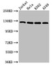 Western Blot<br />
 Positive WB detected in: Jurkat whole cell lysate, Hela whole cell lysate, K562 whole cell lysate, A549 whole cell lysate<br />
 All lanes: POLD1 antibody at 5µg/ml<br />
 Secondary<br />
 Goat polyclonal to rabbit IgG at 1/50000 dilution<br />
 Predicted band size: 124 kDa<br />
 Observed band size: 124 kDa<br />