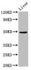 Western Blot<br />
 Positive WB detected in: Mouse liver tissue<br />
 All lanes: PPM1F antibody at 3µg/ml<br />
 Secondary<br />
 Goat polyclonal to rabbit IgG at 1/50000 dilution<br />
 Predicted band size: 50, 39 kDa<br />
 Observed band size: 50 kDa<br />