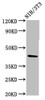 Western Blot<br />
 Positive WB detected in: NIH/3T3 whole cell lysate<br />
 All lanes: RBMS1 antibody at 3.6µg/ml<br />
 Secondary<br />
 Goat polyclonal to rabbit IgG at 1/50000 dilution<br />
 Predicted band size: 45, 5 kDa<br />
 Observed band size: 45 kDa<br />