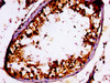 IHC image of CSB-PA020476LA01HU diluted at 1:100 and staining in paraffin-embedded human testis tissue performed on a Leica BondTM system. After dewaxing and hydration, antigen retrieval was mediated by high pressure in a citrate buffer (pH 6.0) . Section was blocked with 10% normal goat serum 30min at RT. Then primary antibody (1% BSA) was incubated at 4°C overnight. The primary is detected by a biotinylated secondary antibody and visualized using an HRP conjugated ABC system.